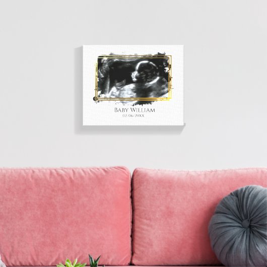 Baby ultrasone Sonogram Afbeelding Verwacht Canvas Afdruk (Insitu (Woonkamer))
