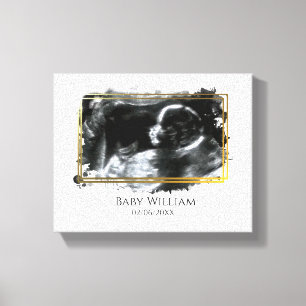 Baby ultrasone Sonogram Afbeelding Verwacht Canvas Afdruk