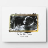 Baby ultrasone Sonogram Afbeelding Verwacht Fotoplaat (Voorkant)