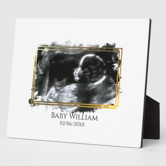 Baby ultrasone Sonogram Afbeelding Verwacht Fotoplaat (Zijkant)