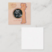 Baby Ultrasound Keepomwille  Notitiekaartje (Voorkant / Achterkant)