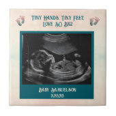 Baby Ultrasound Keepsake Gift Box Tegeltje (Voorkant)