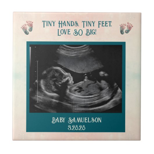 Baby Ultrasound Keepsake Gift Box Tegeltje (Voorkant)
