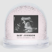 Baby Ultrasound | Sonogram Pregnancy Announcement Sneeuwbol (Achterkant)