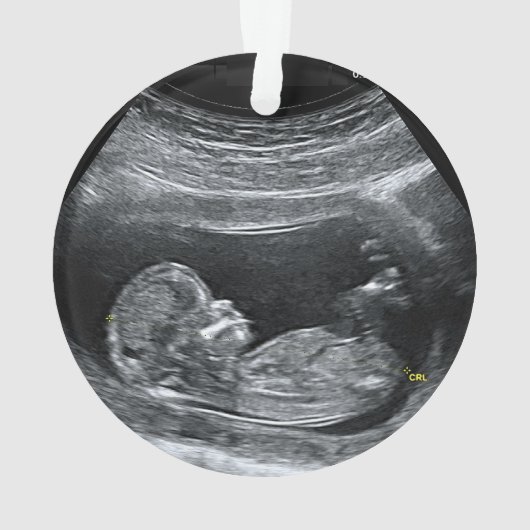 Baby's eerste kerstmis ornament (achterkant)