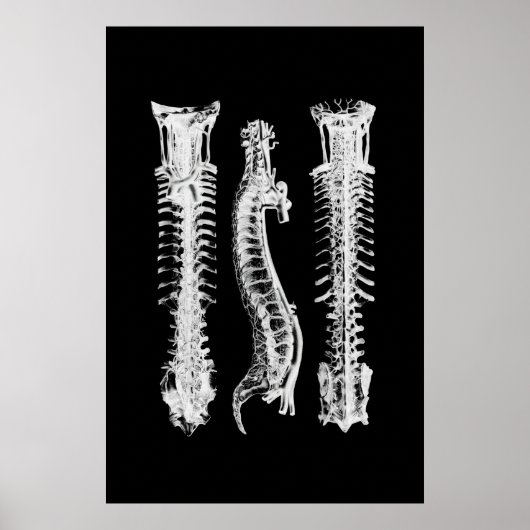 Backbone Anatomy Wall Decor Medical Art Poster (Voorkant)