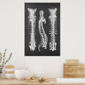 Backbone Vertebrae Anatomy Print no.2 (Keuken)