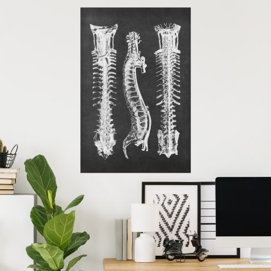 Backbone Vertebrae Anatomy Print no.2 (Thuiskantoor)