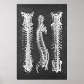 Backbone Vertebrae Anatomy Print no.2 (Voorkant)
