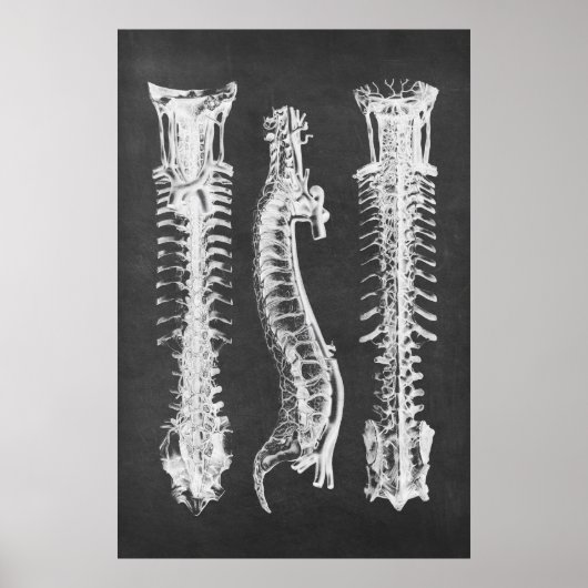 Backbone Vertebrae Anatomy Print no.2 (Voorkant)