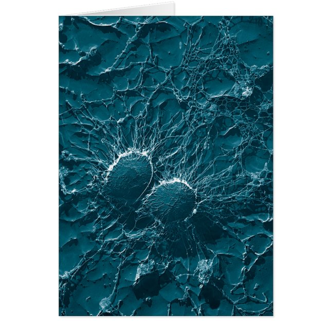 Bacteriële cellen van Staphylococcus aureus Sluite (Voorkant)