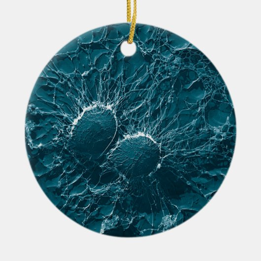 Bacteriële cellen van Staphylococcus aureus Sluite Keramisch Ornament (Voorkant)