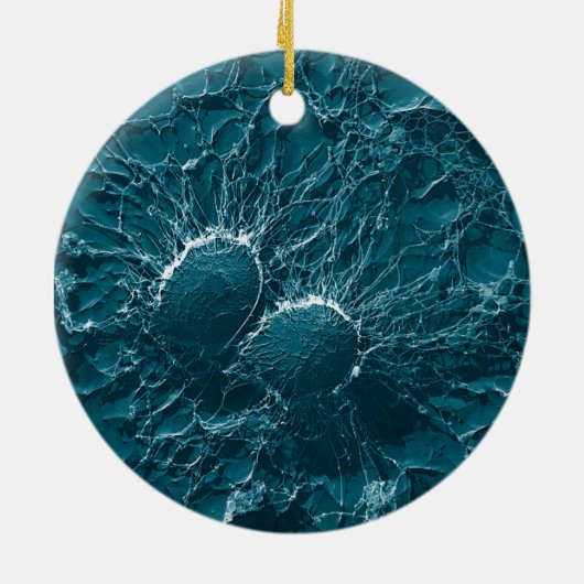 Bacteriële cellen van Staphylococcus aureus Sluite Keramisch Ornament (Achterkant)