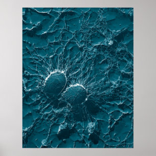 Bacteriële cellen van Staphylococcus aureus Sluite Poster