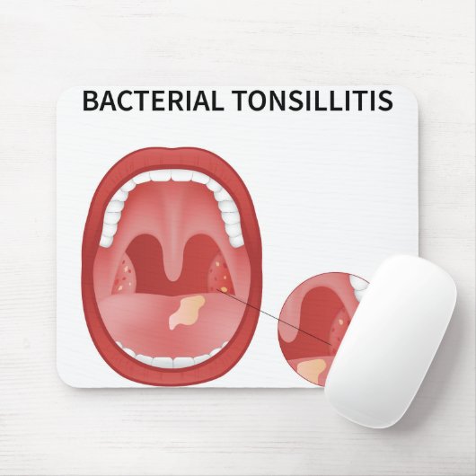Bacteriële tonsillitis muismat (Met muis)