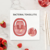 Bacteriële tonsillitis servet (Insitu)