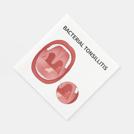 Bacteriële tonsillitis servet (Hoek)