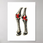 Bad Knees – Funny Skeleton Knee Illustration Poster (Voorkant)
