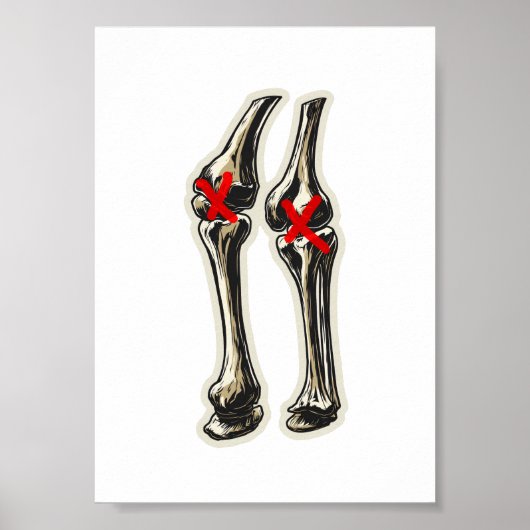 Bad Knees – Funny Skeleton Knee Illustration Poster (Voorkant)