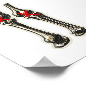 Bad Knees – Funny Skeleton Knee Illustration Poster (Hoek)