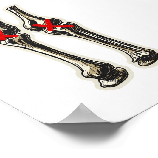 Bad Knees – Funny Skeleton Knee Illustration Poster (Hoek)