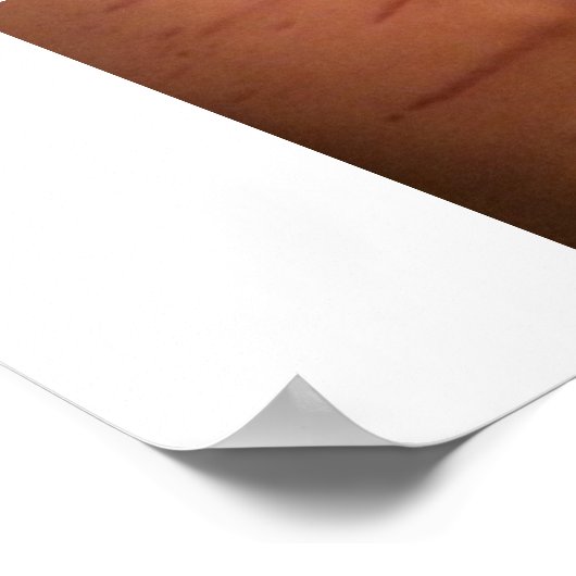 Bartonella Symptoms Educatief Poster (Hoek)