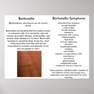 Bartonella Symptoms Educatief Poster