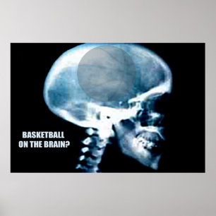 Basketball Head (röntgenfoto) Poster