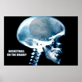 Basketball Head (röntgenfoto) Poster