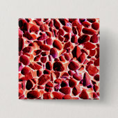 BEACH PEBBLES VIERKANTE BUTTON 5,1 CM (Voorkant)