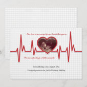 Beating Heart Foto Zwangerschap Aankondiging Aange (Voorkant / Achterkant)