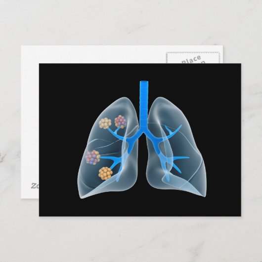 Begripelijk Afbeelding van het menselijk hart 4 Briefkaart (Voorkant / Achterkant)