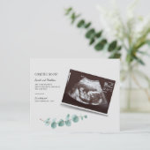 Begroting Eucalyptus Botanische Zwangerschap Baby (Staand voorkant)