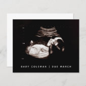 Begroting Zwangerschap Baby Sonogram Ultrageluid F (Voorkant / Achterkant)