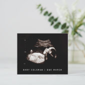 Begroting Zwangerschap Baby Sonogram Ultrageluid F (Staand voorkant)