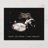 Begroting Zwangerschap Baby Sonogram Ultrageluid F (Voorkant)