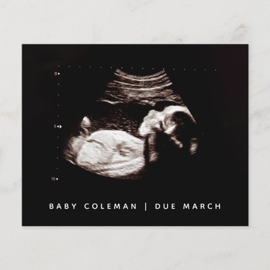 Begroting Zwangerschap Baby Sonogram Ultrageluid F (Voorkant)