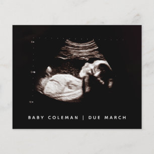 Begroting Zwangerschap Baby Sonogram Ultrageluid F