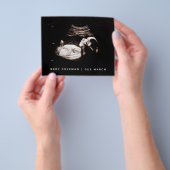 Begroting Zwangerschap Baby Sonogram Ultrageluid F Flyer (Hand)