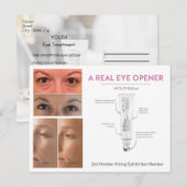 Behandeling van jonge ogen briefkaart (Voorkant / Achterkant)