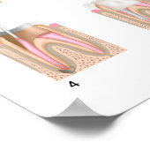 Behandeling van wortelkanaaltjes Poster ongeacht d (Hoek)