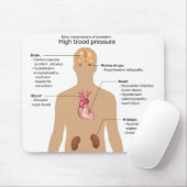Belangrijkste complicaties van de hoge bloeddrukme muismat (Met muis)