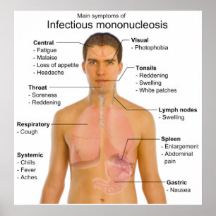Belangrijkste symptomen van infectieuze mononucleo poster