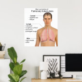 Belangrijkste symptomen van longtuberculose Grafie Poster (Thuiskantoor)