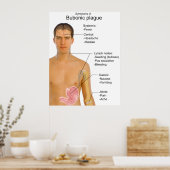 Belangrijkste symptomen van zwarte doodbloemen poster (Keuken)