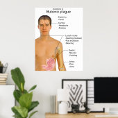 Belangrijkste symptomen van zwarte doodbloemen poster (Thuiskantoor)