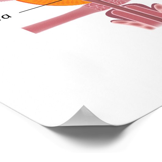 Benigne prostaathyperplasie, gelabeld schema. poster (Hoek)