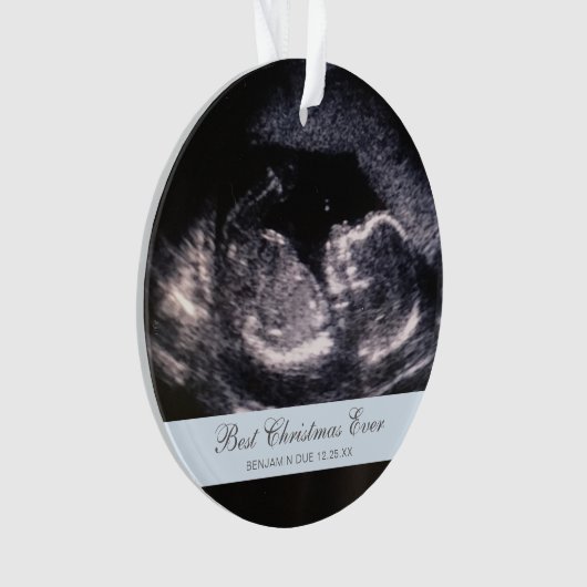 Best Kerstmis ooit Cute Ultrasound Boy Foto Ornament (voorkant)