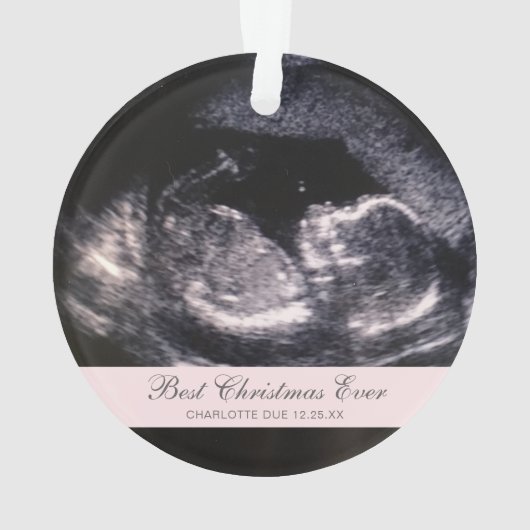 Best Kerstmis ooit Cute Ultrasound Girl Foto Ornament (achterkant)