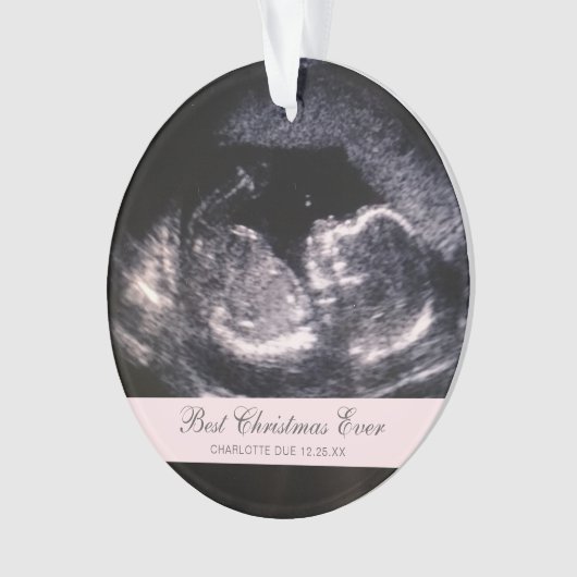 Best Kerstmis ooit Cute Ultrasound Girl Foto Ornament (voorkant)